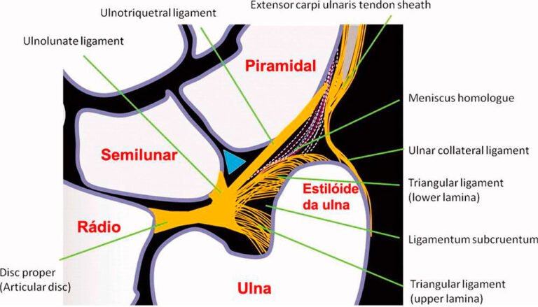 Lesão do Complexo da Fibrocartilagem Triangular | Dr Diego