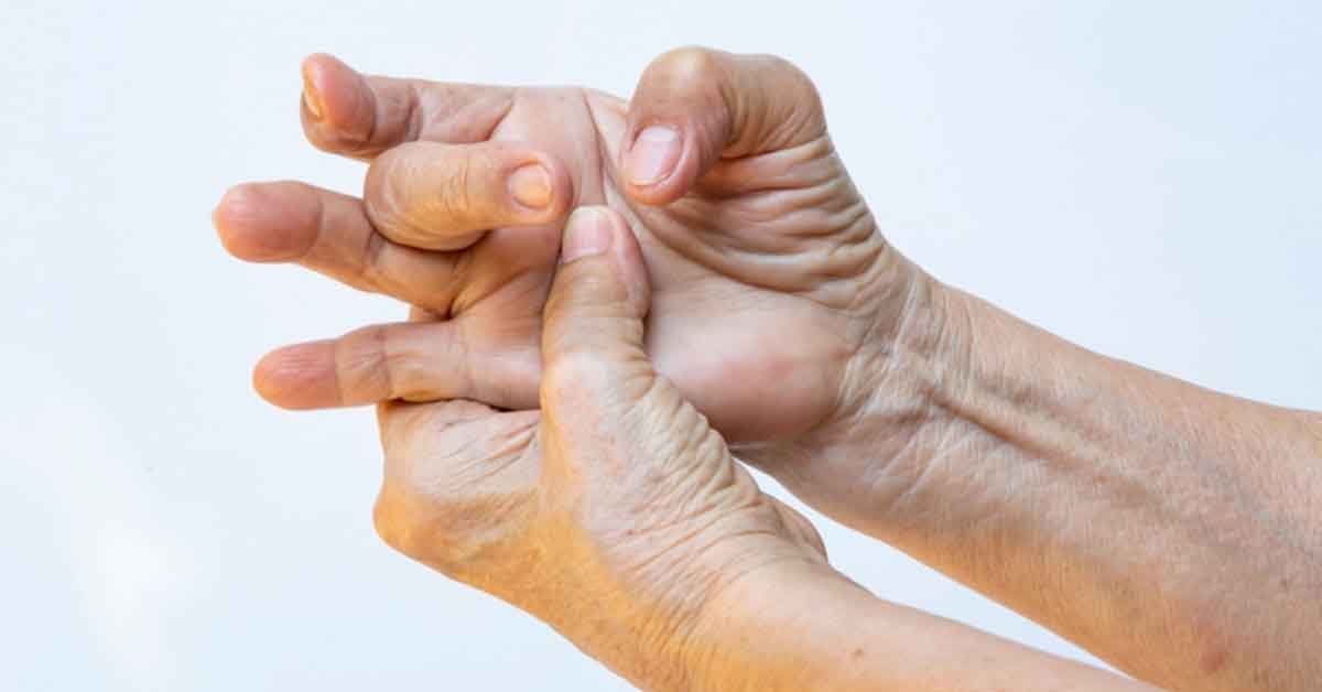 Tratamento do dedo em gatilho (dedo que trava)